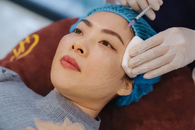 Tiêm meso (Mesotherapy) — Xu hướng trẻ hóa da tầng sâu dẫn đầu kỷ nguyên thẩm mỹ nội khoa.