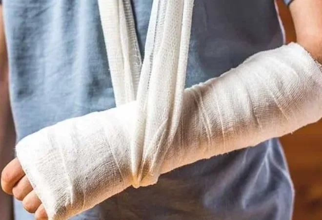 Gãy tay có ăn được thịt gà không? Câu trả lời chính xác nhất