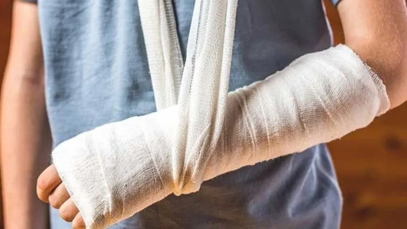 Gãy tay có ăn được thịt gà không? Câu trả lời chính xác nhất